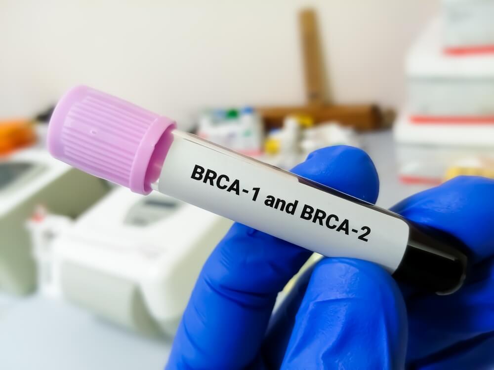 BRCA是什麼？乳癌遺傳基因